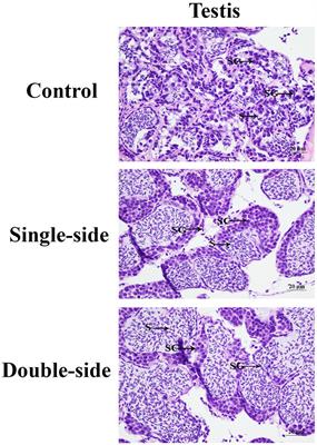 Transcriptome Profiling Analysis of the Testis After Eyestalk Ablation for Selection of the Candidate Genes Involved in the Male Sexual Development in Macrobrachium nipponense